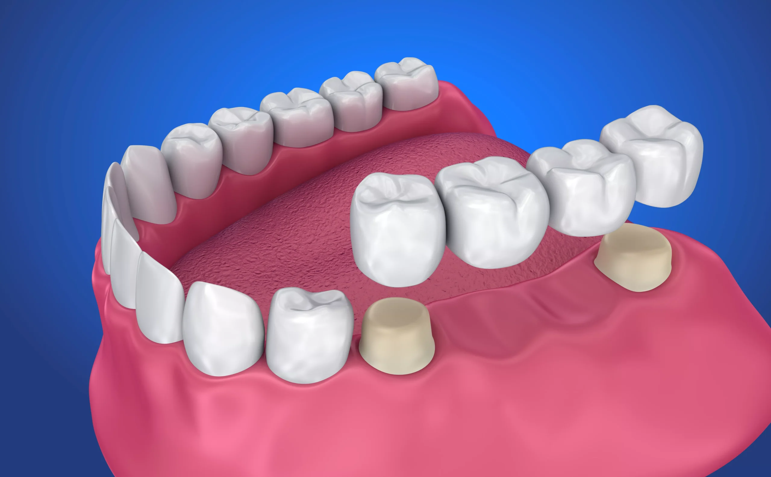 https://yongedentalcare.com/wp-content/uploads/2024/06/shutterstock_699897964-scaled.webp