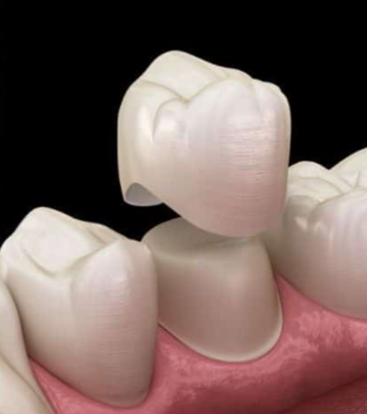 Better Denture Fit with Professional Reline in Richmond Hill