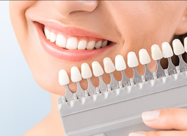 Cosmetic Dentistry North York. Cosmetic dentistry before and after